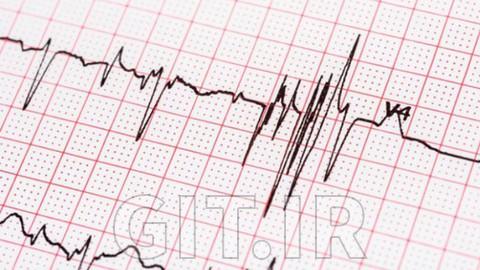 راهنمای ECG - تسلط به ECG، یک نبض در هر بار
