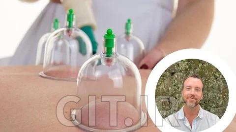 یادگیری بادکش‌ درمانی چینی: رهایی سریع از تنش عضلانی