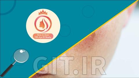 تسلط به پوست حساس و آسیبدیده: از علم تا عمل تسلط به پوست حساس و آسیبدیده: از علم تا عمل